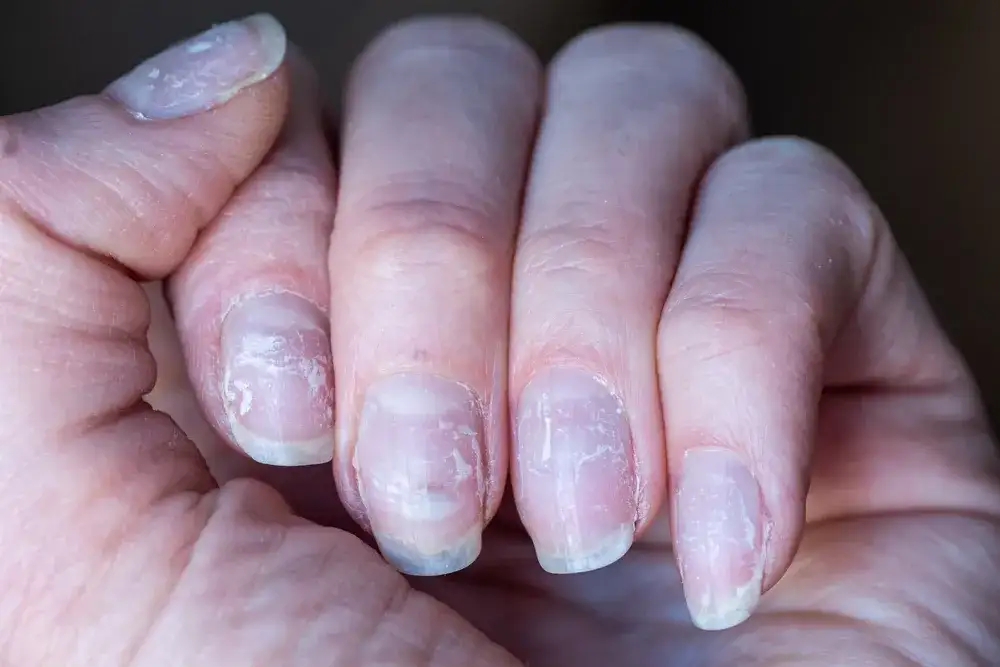 Skuteczne sposoby jak wzmocnić paznokcie po hybrydzie: 5 sprawdzonych metod