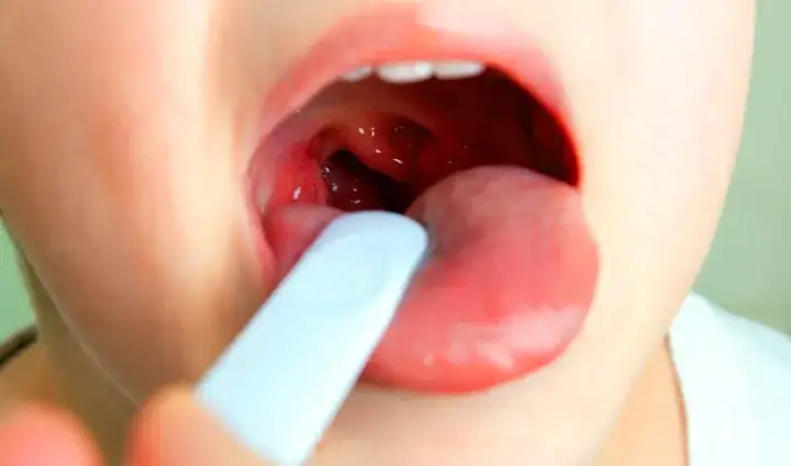 Objawy bólu gardła u niemowlaka – jak je rozpoznać i złagodzić ból