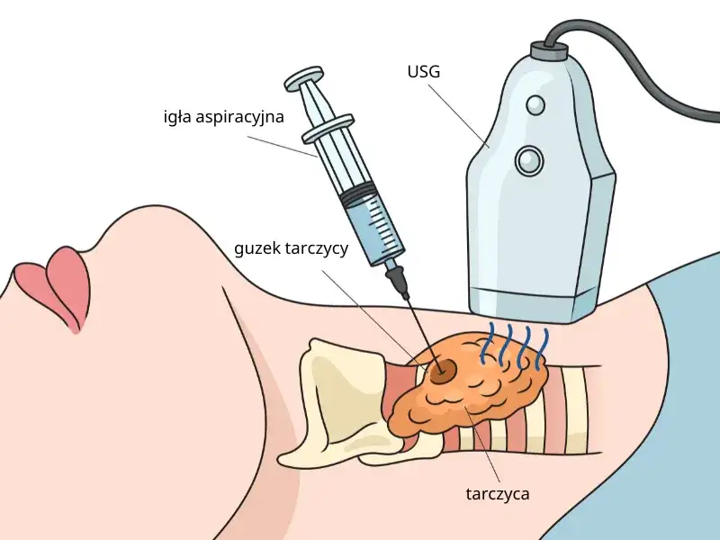 Badanie tarczycy: jak wygląda, przygotowanie, wyniki krok po kroku