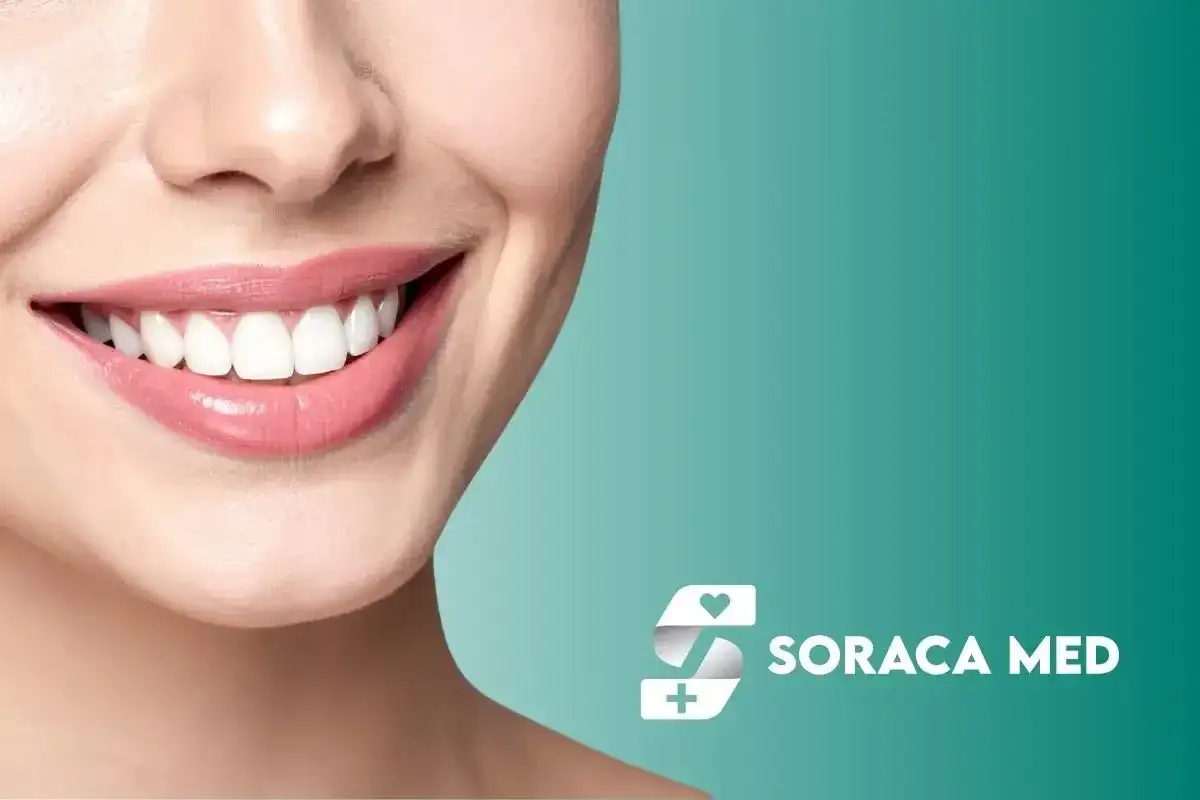 Uśmiechnięta twarz z białymi zębami. Sprawdź koszty leczenia w Turcji z Soraca Med.