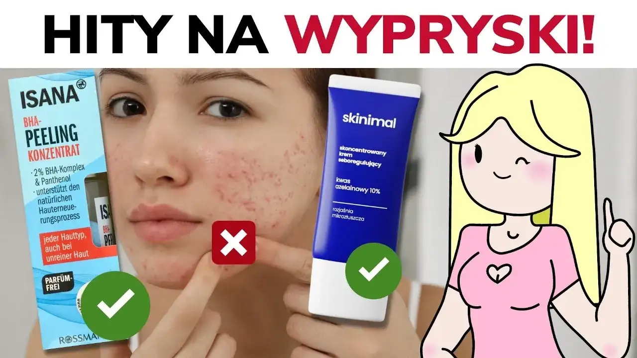 Czym smarować pryszcze? Skuteczne metody, by zniknęły szybko i bez śladu