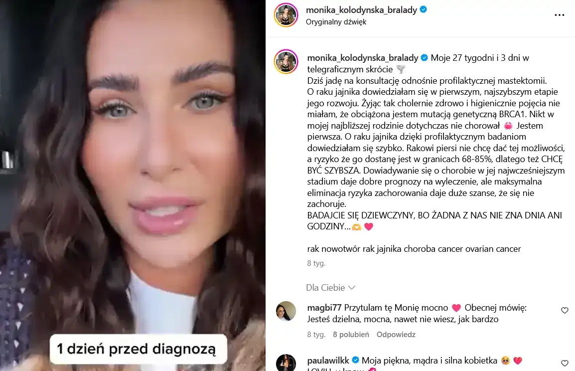 Wczesne objawy raka jajnika, które mogą uratować życie kobietom