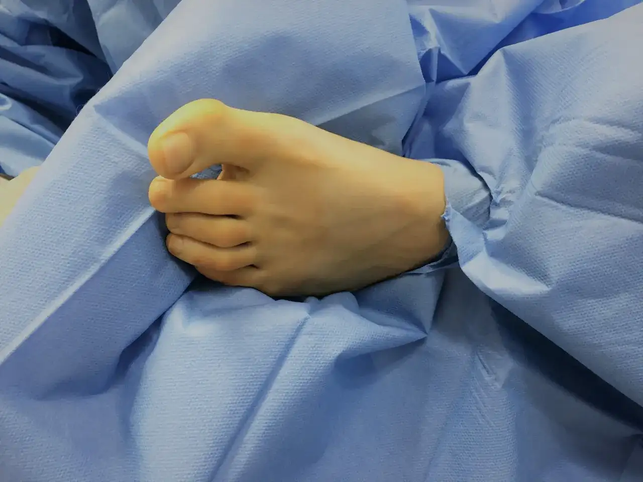 Krzywy palec u nóg dziecka: przyczyny, objawy i skuteczne leczenie