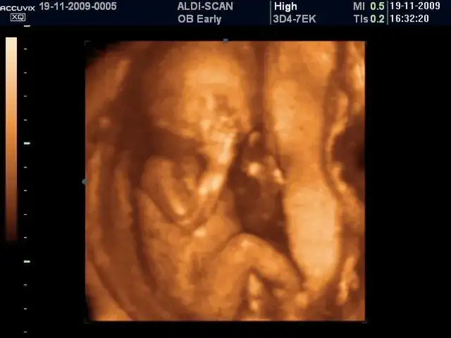 11 tygodni na miesiące: Poznaj dokładne przeliczenie czasu