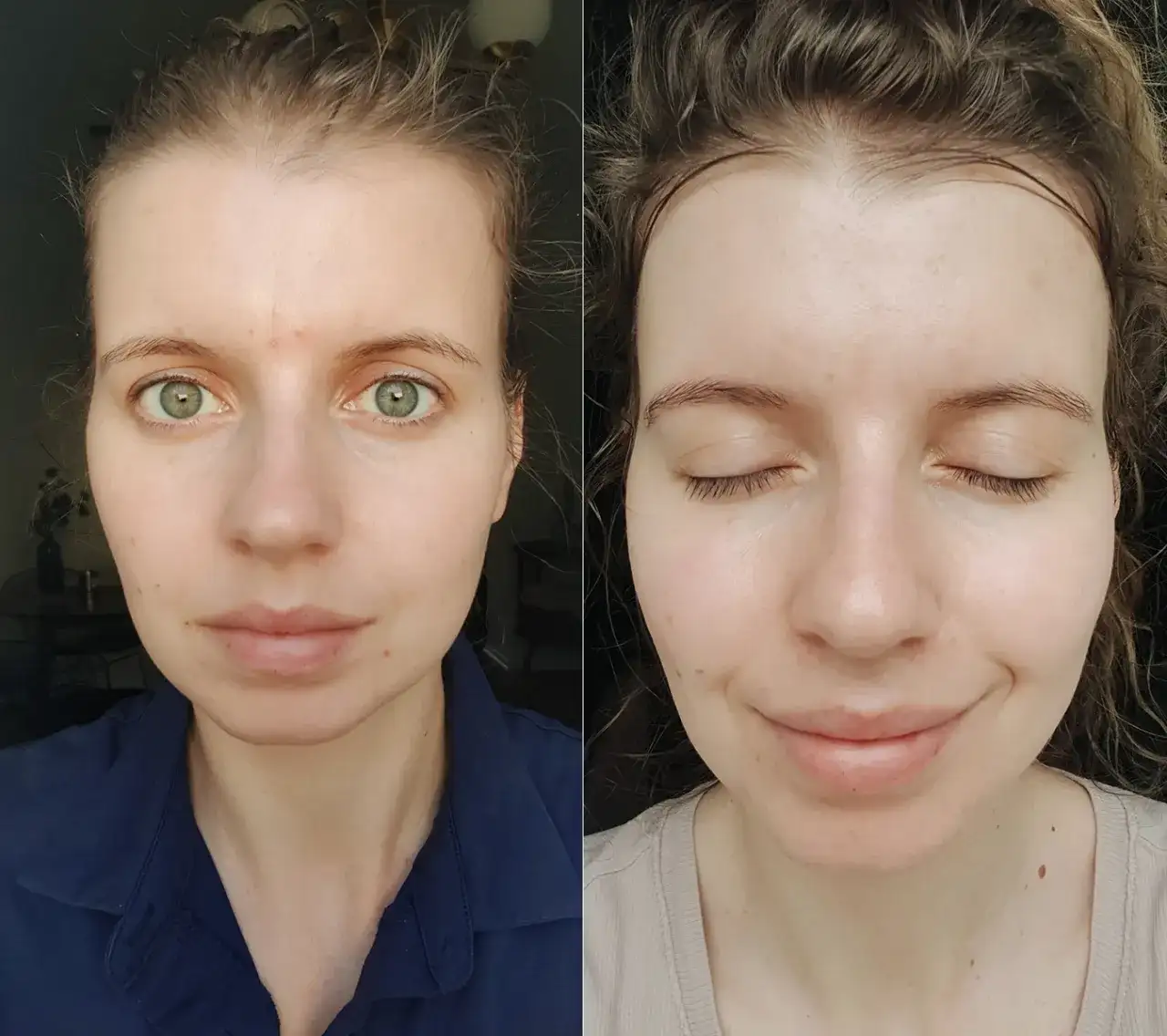 Jak mieć ładną cerę bez makijażu: skuteczne sposoby na zdrową skórę