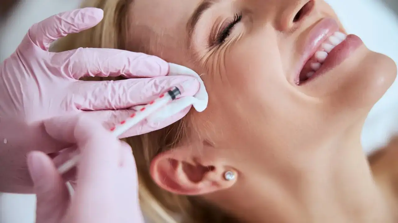 Ile kosztuje botoks na kurze łapki? Ceny w Polsce i co wpływa na nie