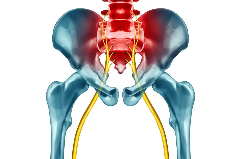 Jakie badania są potrzebne przy rwie kulszowej, aby uniknąć bólu?