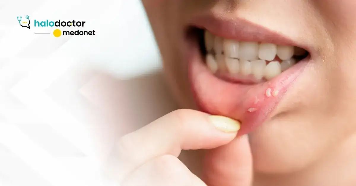 Choroby jamy ustnej: Do jakiego lekarza się udać?