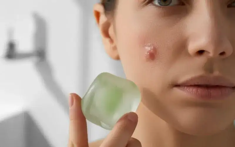 Jak zmniejszyć pryszcza? Szybkie i bezpieczne metody SOS