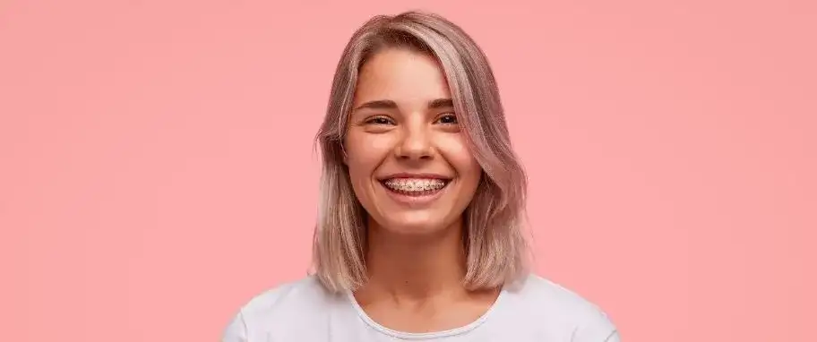 Czy aparat na zęby jest modny? Odkryj trendy i nowoczesne rozwiązania