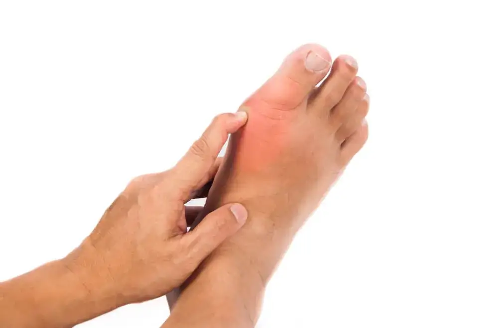 Jakie są przyczyny dny moczanowej i jak ich uniknąć?