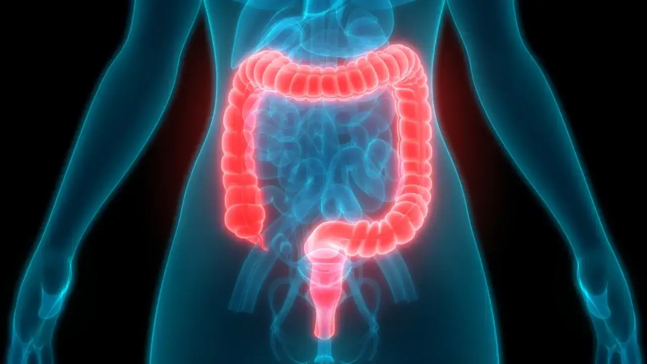 Rak jelita grubego: Wczesne objawy, które ratują życie. Sprawdź!