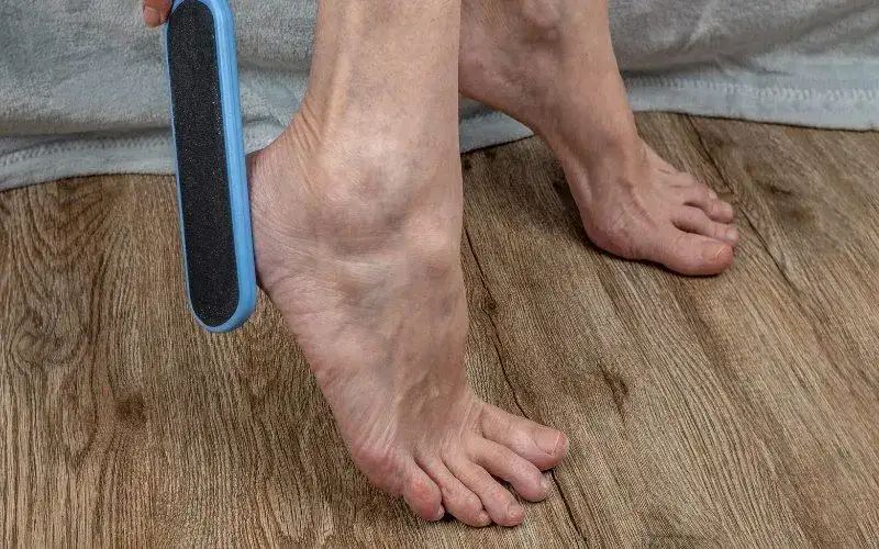 Skuteczne sposoby na otarcia na stopach - zapobieganie i leczenie