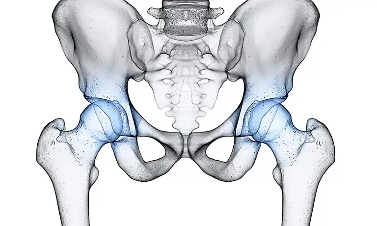 Endoproteza stawu biodrowego NFZ - gdzie najszybciej bez czekania