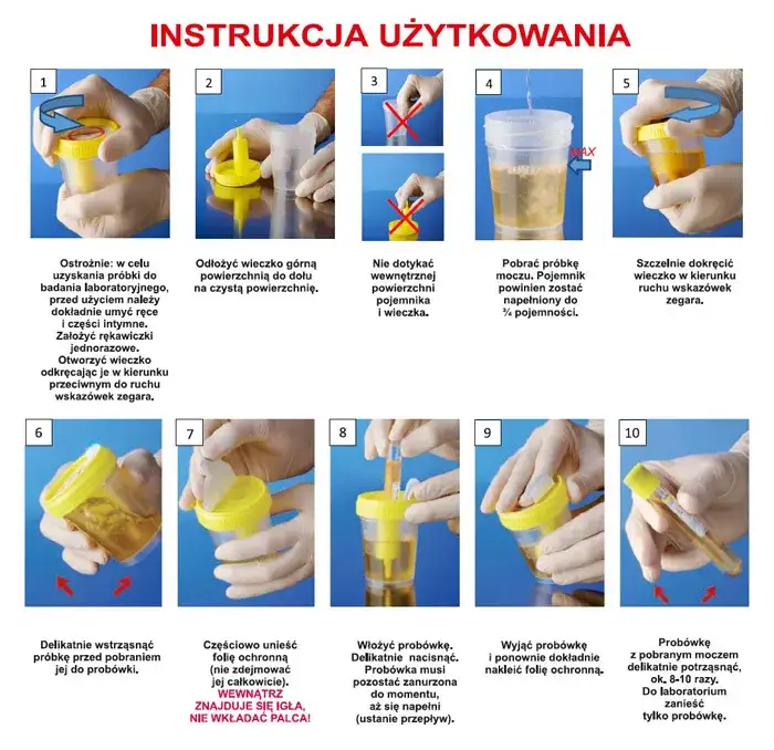 Jak prawidłowo przechowywać mocz? Instrukcja dla pewnych wyników