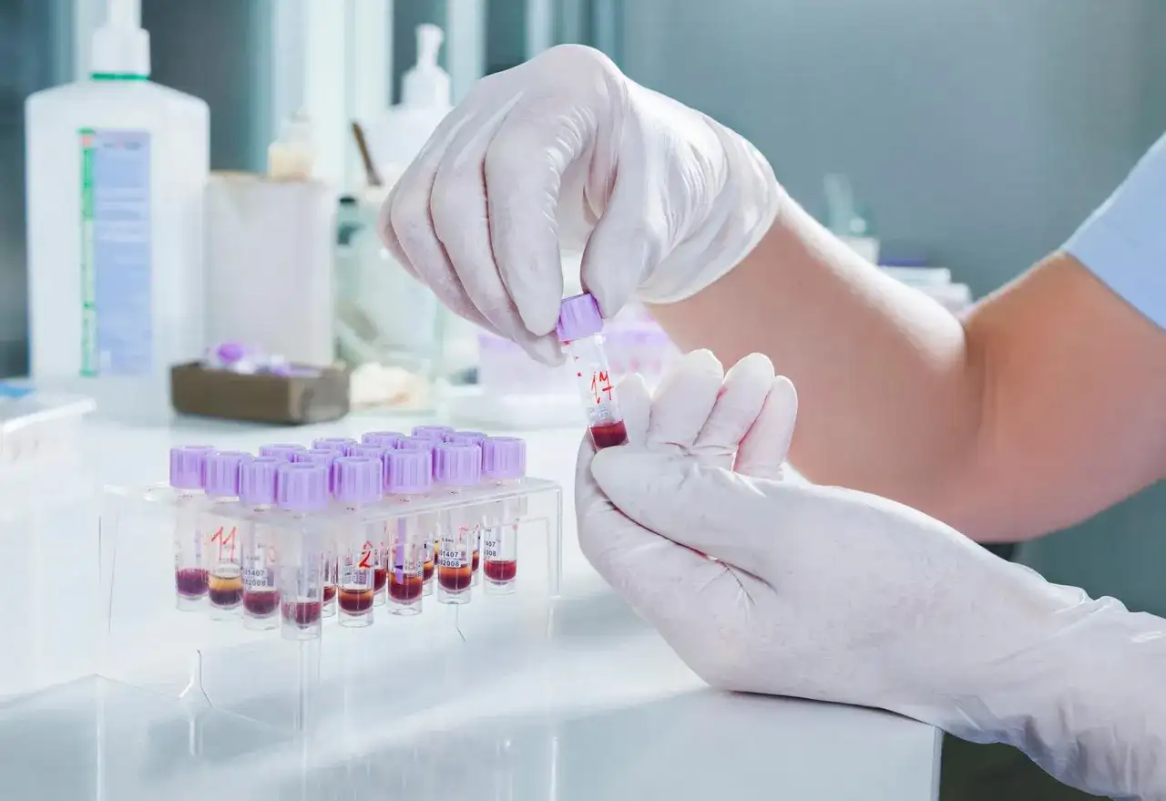 Czy badania krwi można robić podczas okresu? Sprawdź, co musisz wiedzieć