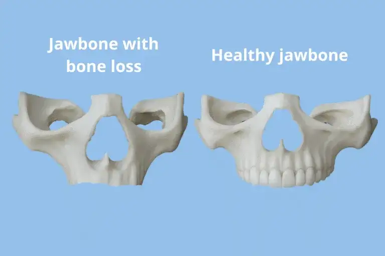 Ząb to nie kość: Dlaczego to ważne dla Twojego zdrowia?