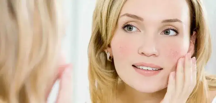 Jaki kolor włosów do cery naczynkowej, aby zminimalizować zaczerwienienia?