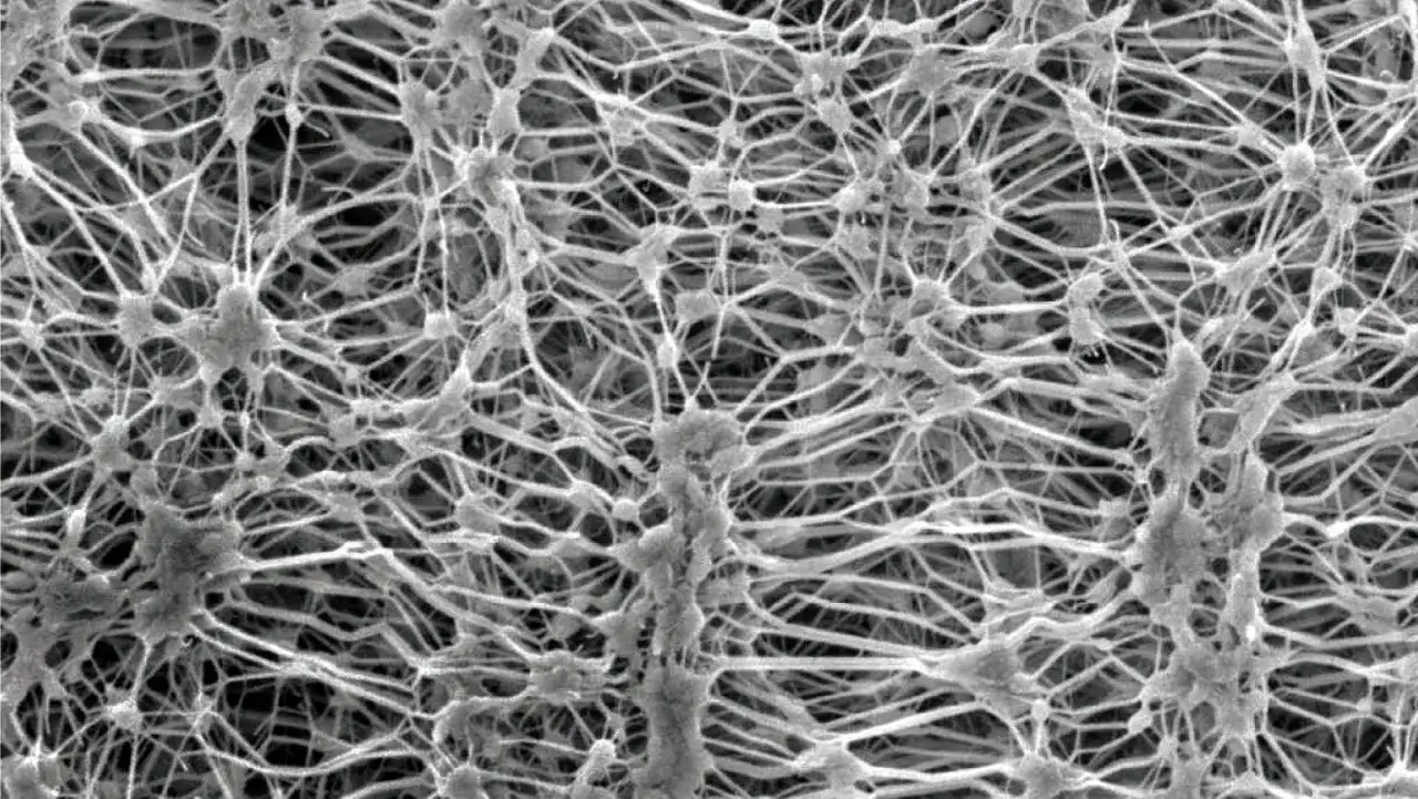 Mikroskopowe spojrzenie na strukturę membrany. Czy to DryVent vs Gore-Tex? Sieć włókien tworzy skomplikowany wzór.