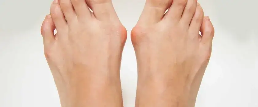 Od czego robią się haluksy? Genetyka, buty i nie tylko!