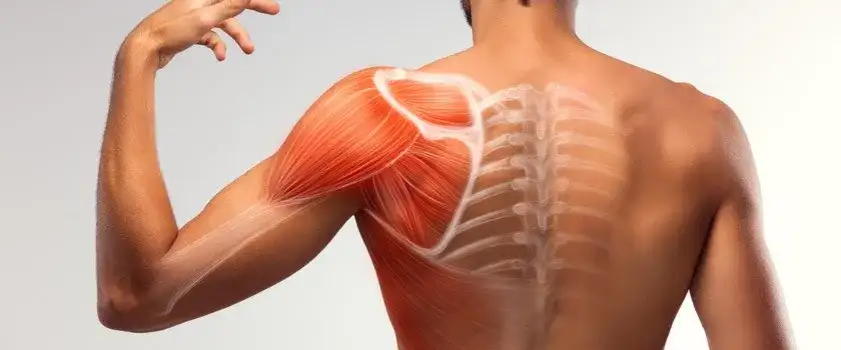 Naciągnięcie mięśnia barku: rozpoznaj objawy i zacznij skuteczne leczenie
