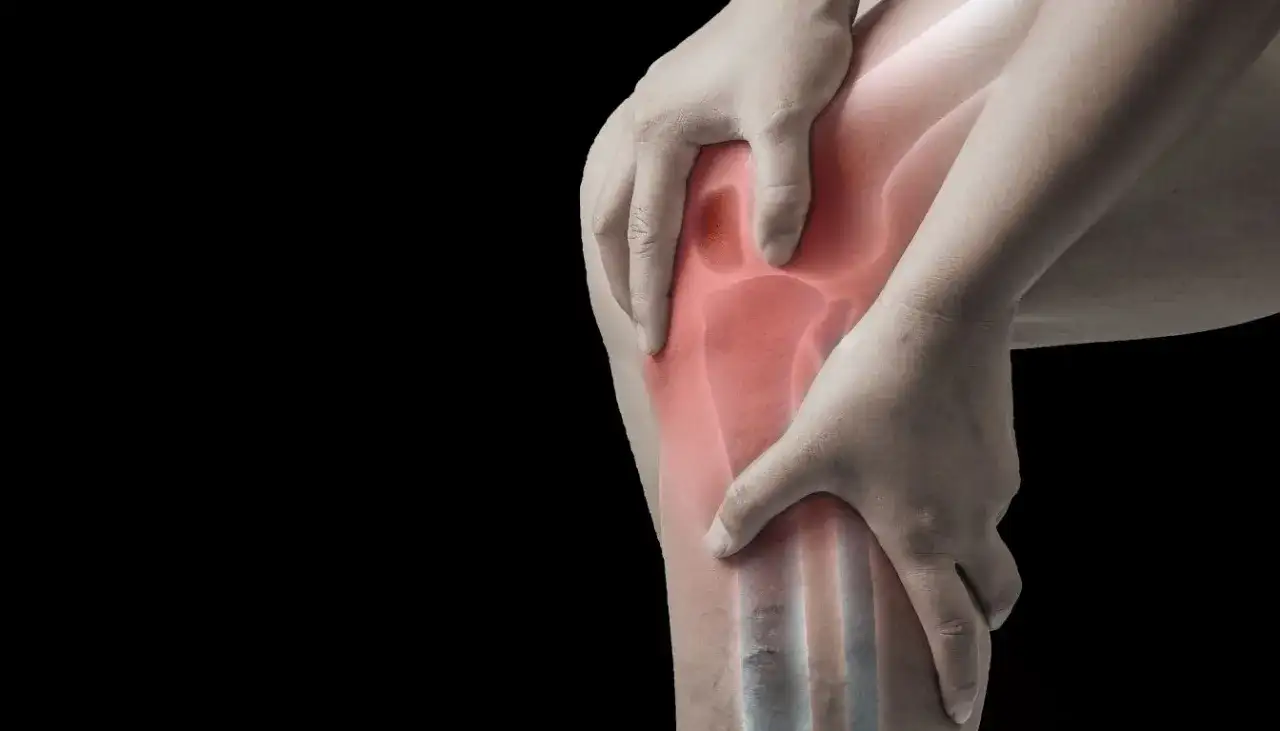 Skręcenie kolana ile zwolnienia: ile dni potrzebujesz na powrót?