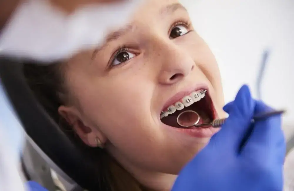 Ortodonta czy dentysta? Kto założy aparat na zęby?