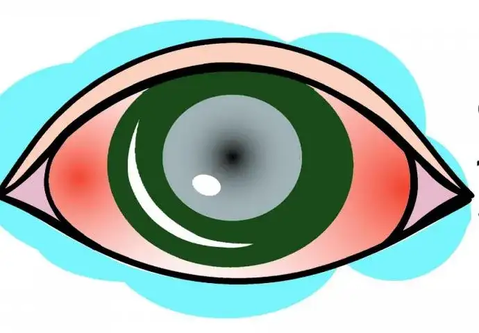 Czego nie wolno robić przy jaskrze, aby uniknąć poważnych problemów