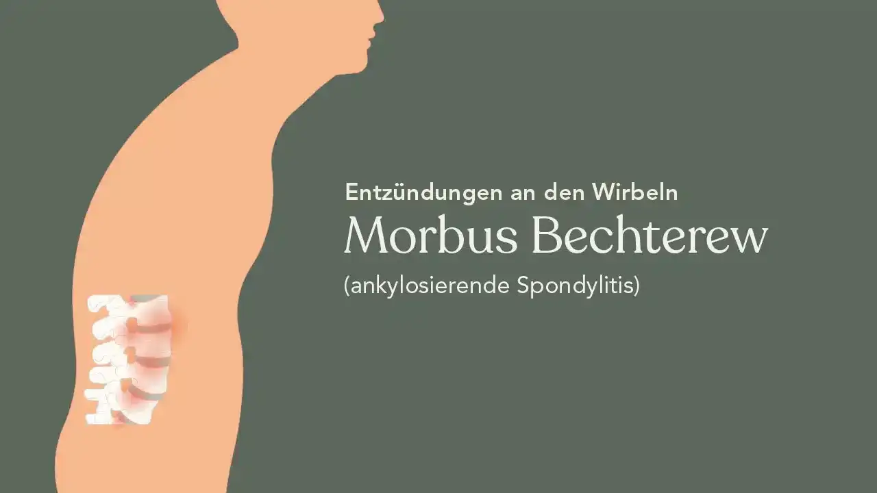 Die entscheidenden Schritte zur Diagnostik von Morbus Bechterew