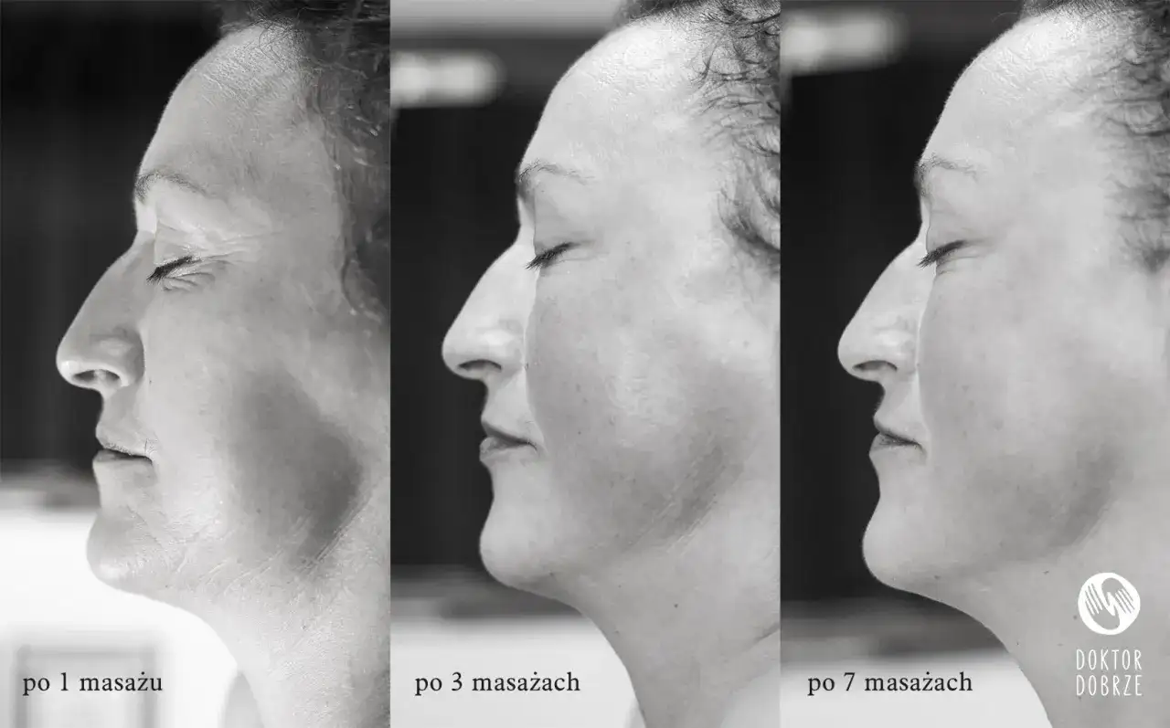 Masaż Kobido: Naturalny lifting twarzy? Poznaj efekty i etapy