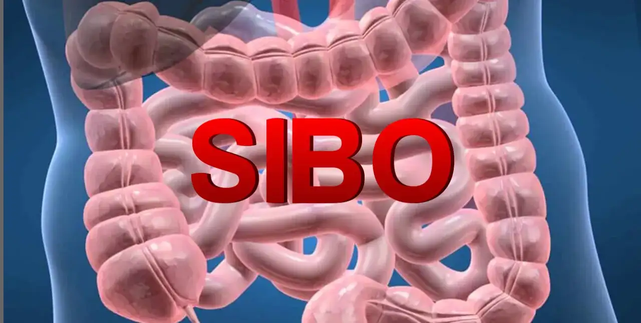 SIBO: przerost flory bakteryjnej i jego skutki dla zdrowia.