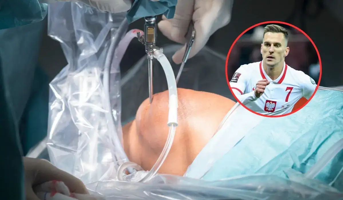 Najszybsza artroskopia kolana NFZ – terminy i dostępność w Polsce