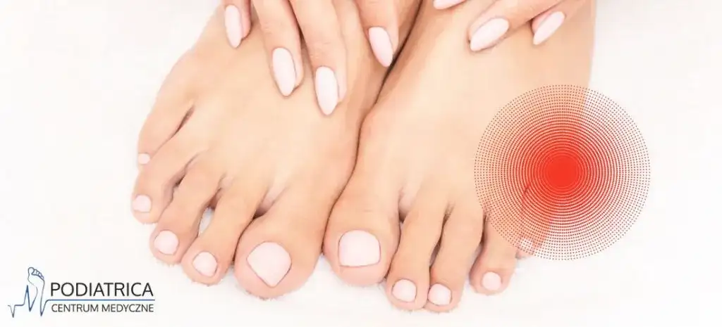 Kostka Krawca: Leczenie Domowe, Operacja i Profilaktyka