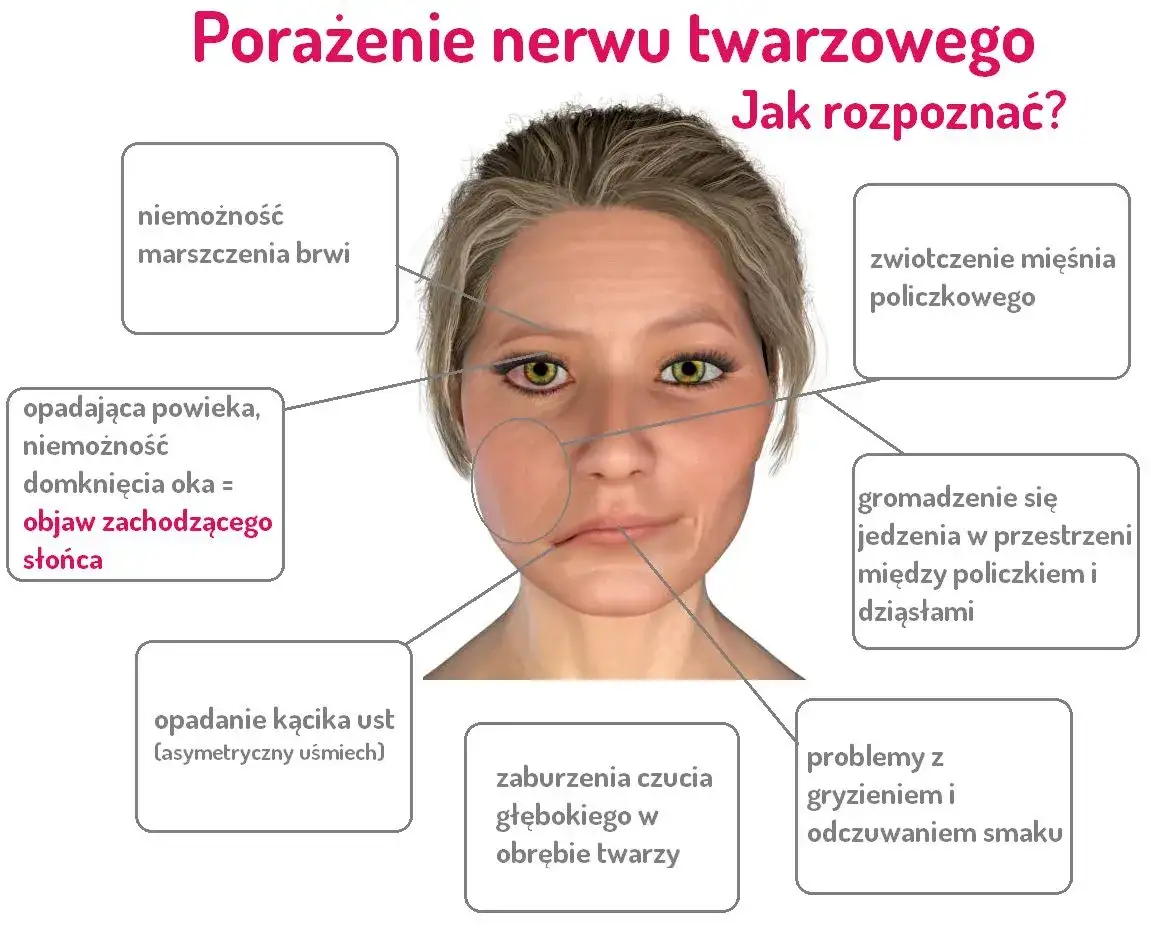 Ból twarzy i dziąseł po przewianiu? Poznaj objawy i skuteczne leczenie