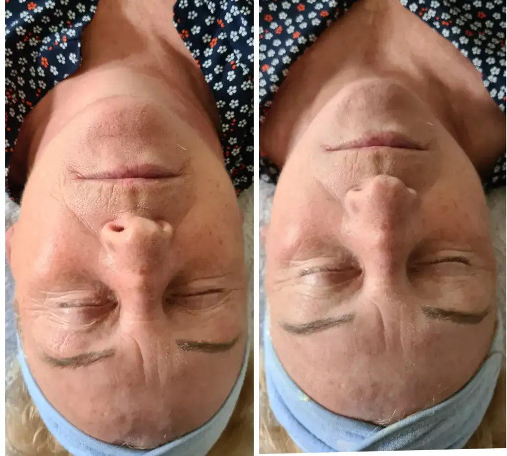 Masaż Kobido: Czy warto? Opinie, efekty, cena i przeciwwskazania