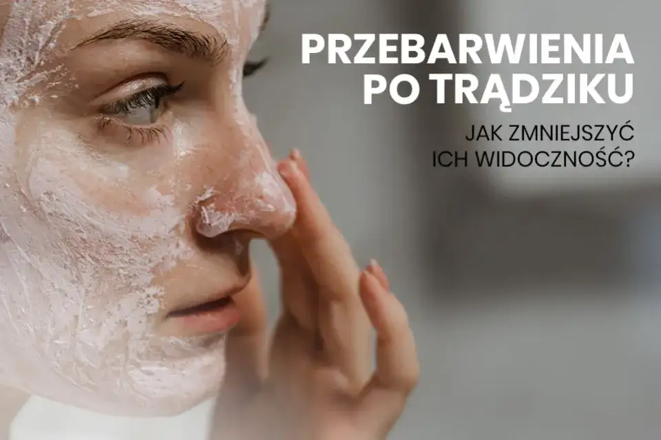 Jak pozbyć się blizn po pryszczach? Domowe i profesjonalne metody