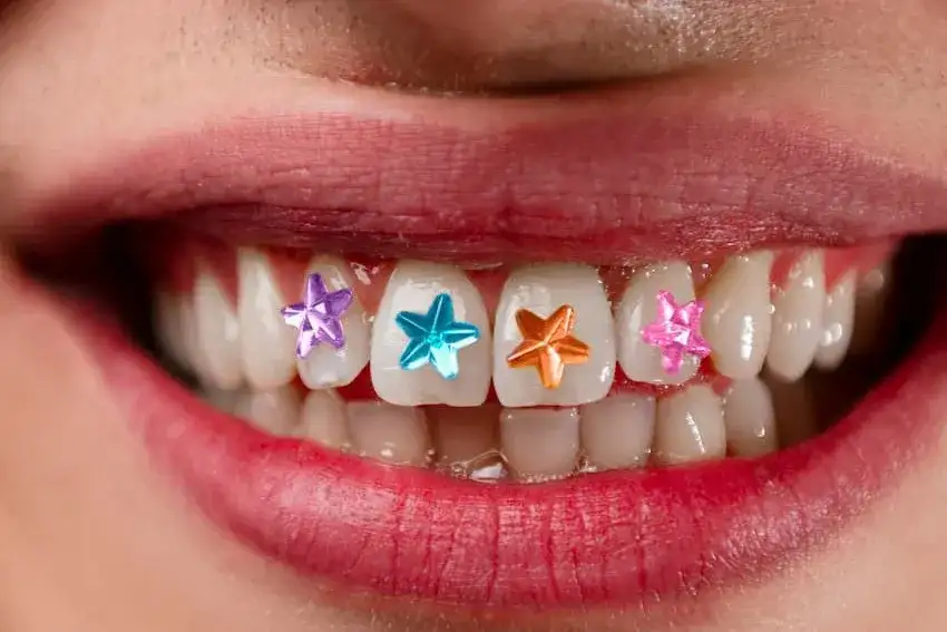 Biżuteria nazębna jak zrobić - uniknij błędów przy aplikacji