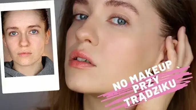 Makijaż na pryszcze: Ukryj niedoskonałości, poczuj się pewniej!