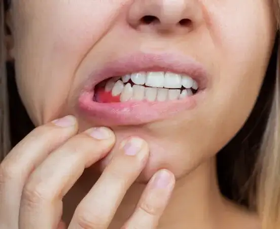 Objawy nowotworu dziąseł – nie bagatelizuj tych niepokojących sygnałów