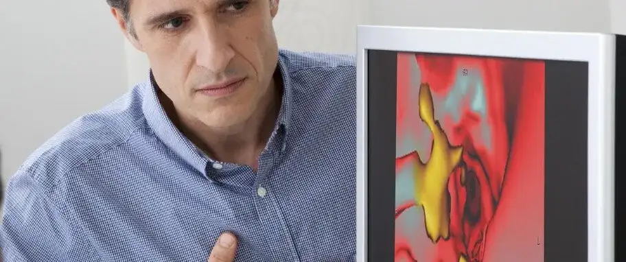 Miażdżyca przyczyna: Jak unikać najważniejszych czynników ryzyka