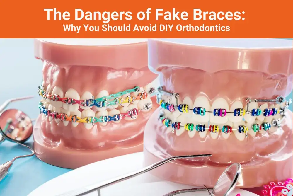 Fake braces: Jak zrobić i dlaczego to zły pomysł?