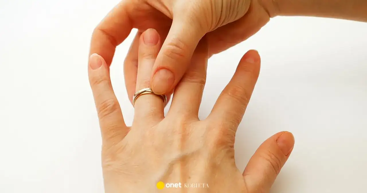 Jak zdjąć obrączkę z palca? Domowe triki i pomoc ekspertów.