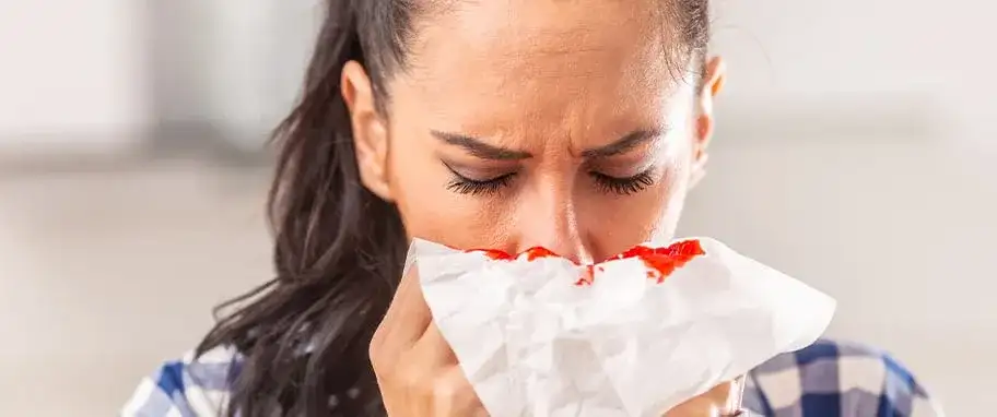 Krwawienia z nosa przyczyna: najczęstsze powody i jak im zapobiegać