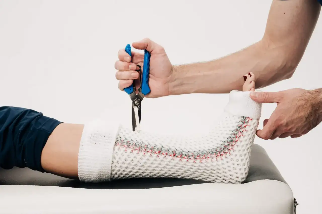 Czy na skręconą kostkę zakłada się gips i kiedy jest to konieczne?