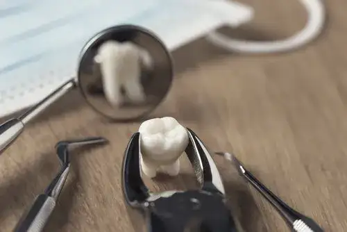 Ból po wyrwaniu zęba: Jak długo trwa i kiedy iść do dentysty?