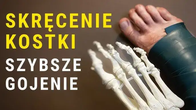 Jak skutecznie zabandażować skręconą kostkę i przyspieszyć gojenie