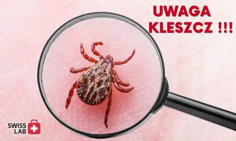 Kleszcz sam odpadnie? Poznaj ryzyko i usuń go bezpiecznie!