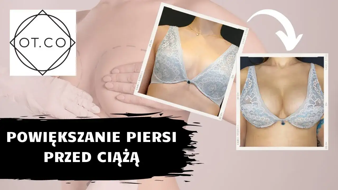 Naturalne powiększanie biustu: Fakty, mity i co naprawdę działa?