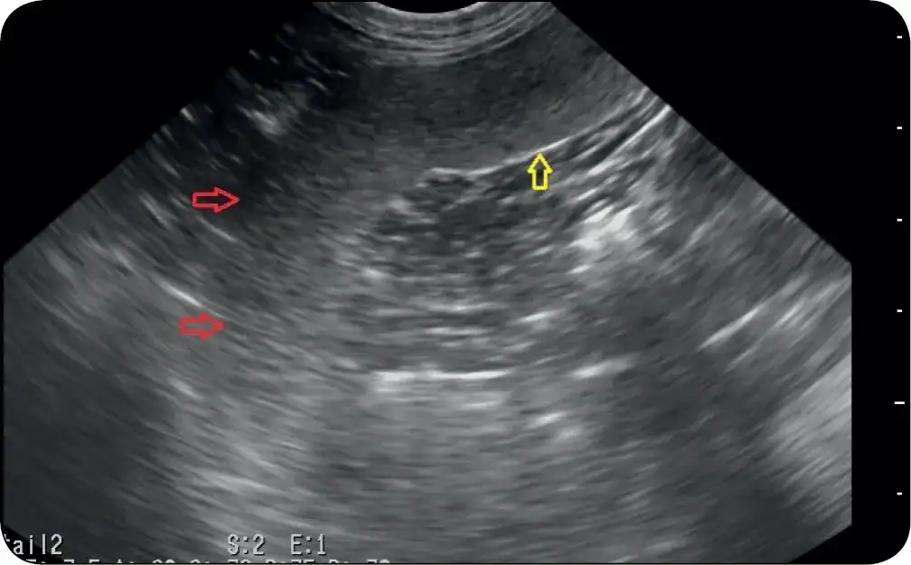 Śledziona u psa: jakie choroby jej dotyczą i jak skutecznie leczyć?