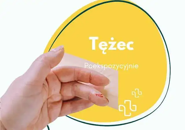 Skutki uboczne szczepienia na tężec: co warto wiedzieć o reakcjach?